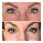Lantz Copenhagen 60sec Instant Wrinkle Reducer