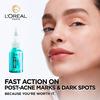 L'Oréal Paris Bright Reveal Peeling For Dark Spots - 25 ml.