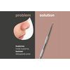 Australian Bodycare Blackhead Remover - 1 stk.