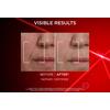 L'Oréal Paris Revitalift Laser Day Cream - 50 ml.