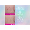 Nuxe Zinc Power Blemish And Spot Control Serum - 30 ml.
