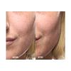 Grown Alchemist Skin Renewal Serum  - 25 ml.