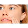 Dermalogica Deep Breakout Liquid Patch - 15 ml.