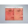 Dermalogica Stabilizing Repair Cream - 50 ml.
