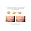 Dermalogica Biolumin-C Serum - 30 ml