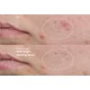 Dermalogica Active Clearing Age Bright Clearing Serum - 30 ml.