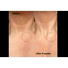 The Inkey Bio-Active Ceramide Neck Lift Stick - 20 g.