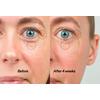 The Inkey Bio-Active Ceramide Eye Cream - 18 ml.