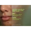 Murad Biome-Balancing Calm + Recover Cream - 50 ml.