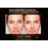L'Oréal Paris Age Perfect Cell Renewal Midnight Serum - 30 ml.