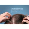 DUCRAY Anaphase Anti-Hair Loss Shampoo - 200 ml.